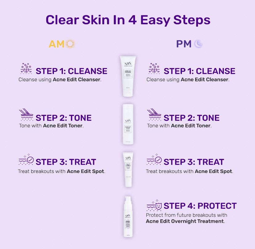 4-Step Acne System